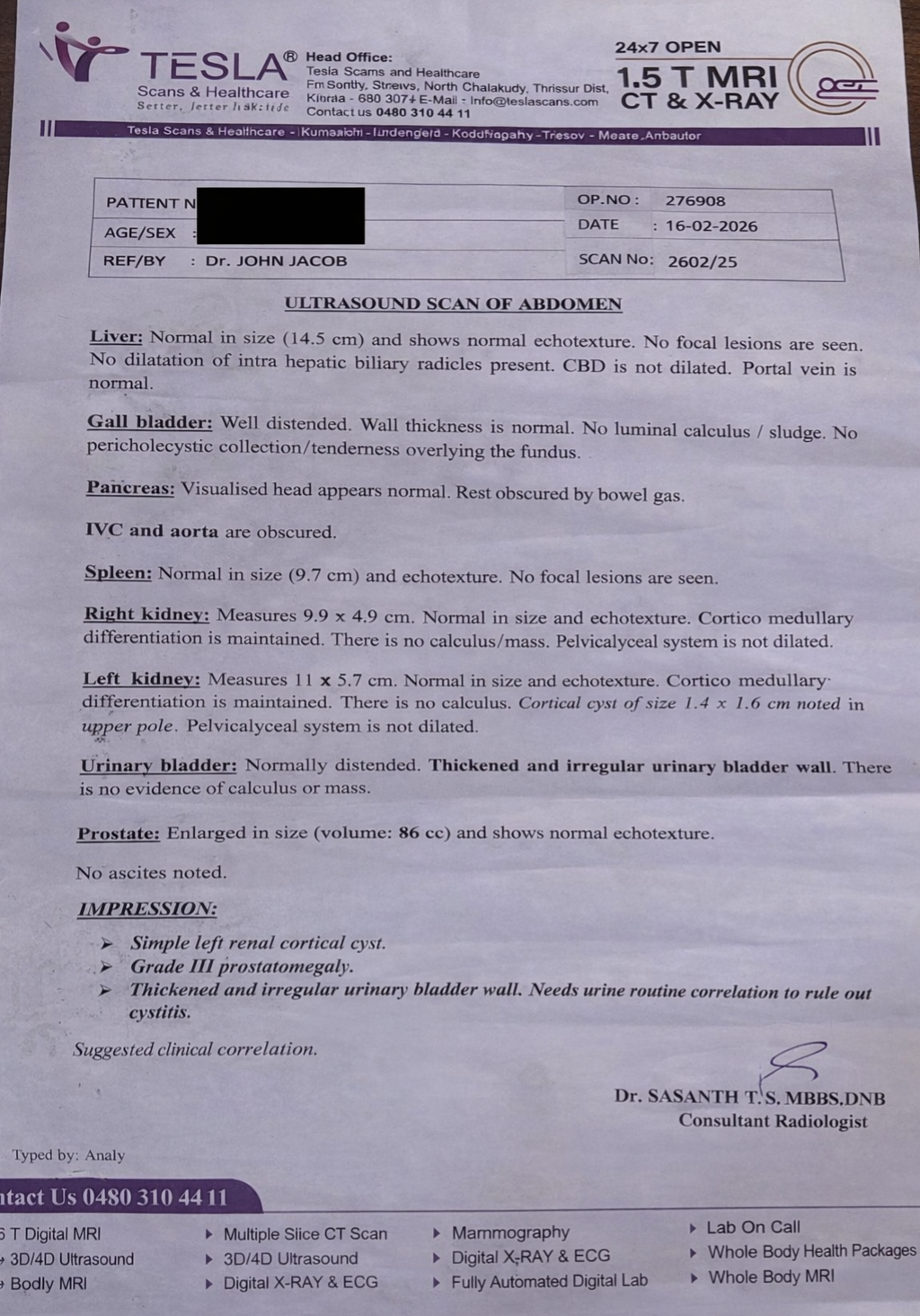 vincent prostate after 86 cc